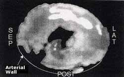 After Image